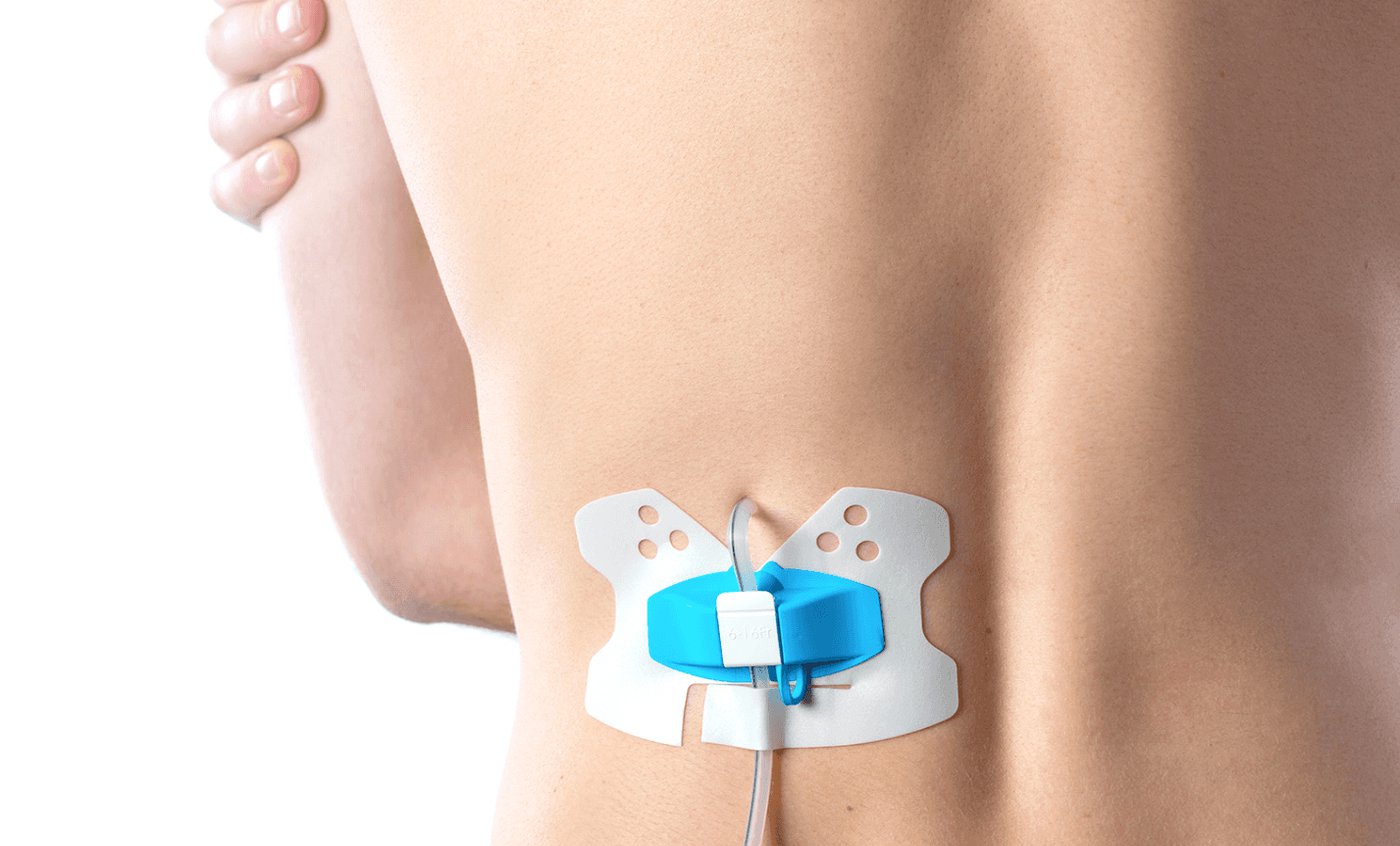 Limburgse specialist in medical devices tankt 3,25 miljoen euro